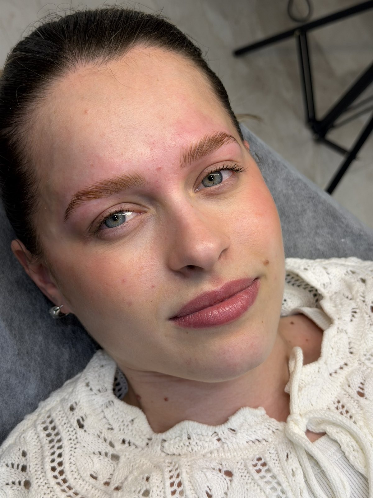 Brow Lift — θεραπεία φρυδιών